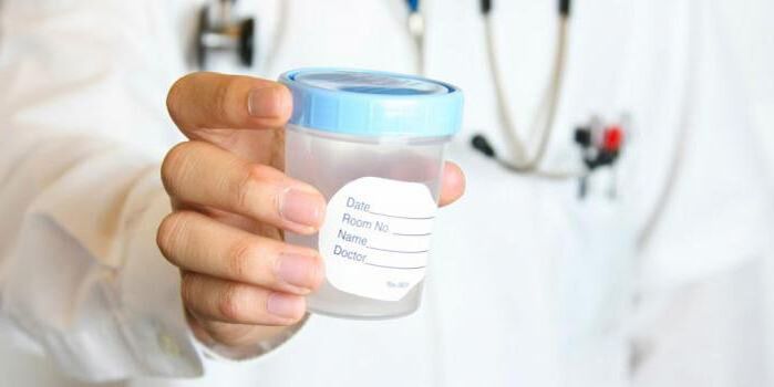 An increased amount of lubricant is a reason to consult a doctor and get tested